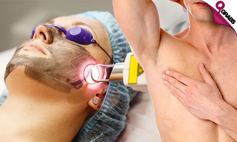 Carbon Peel & Laser Lightening or Toning Treatments!